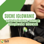 igłowanie