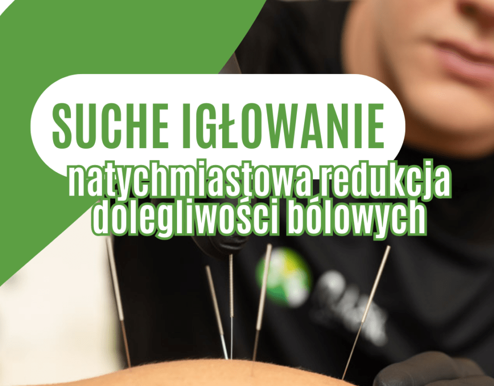 igłowanie