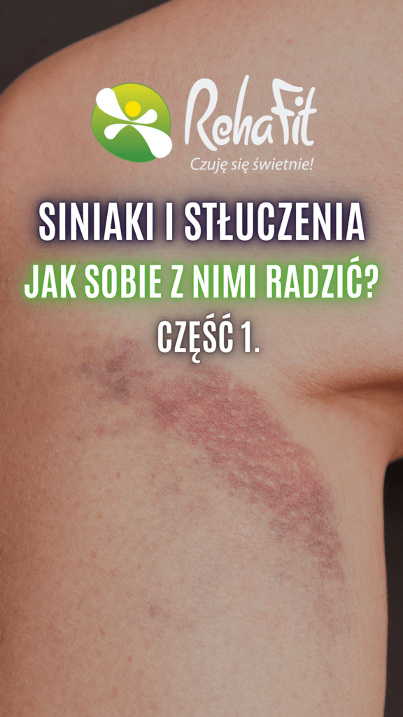 stłuczenia