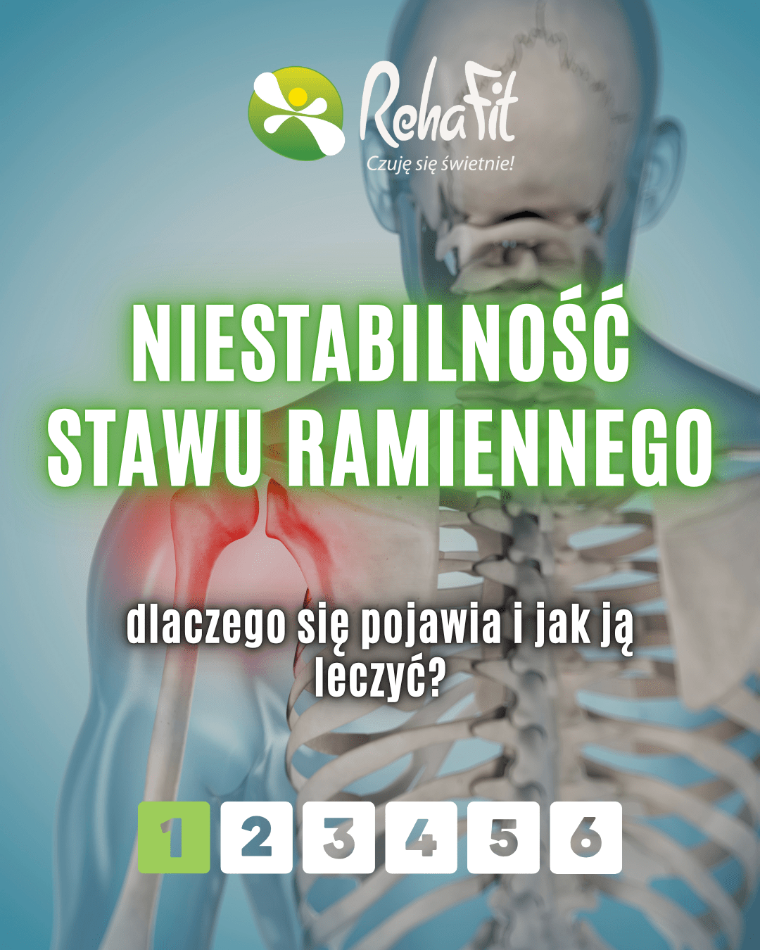 niestabilność stawu ramiennego