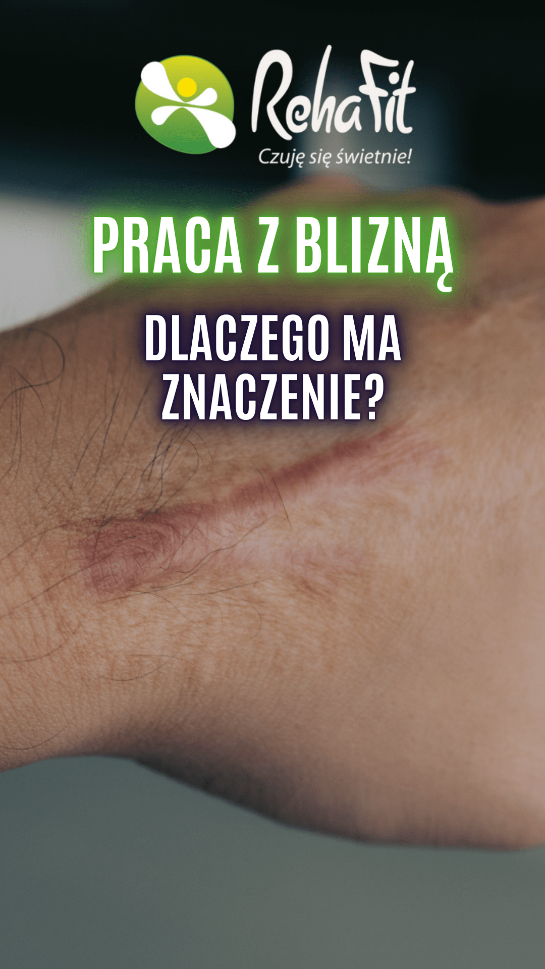 praca z blizną
