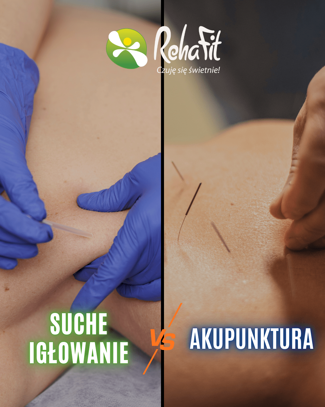 suche igłowanie