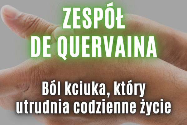 zespół de Quervaina
