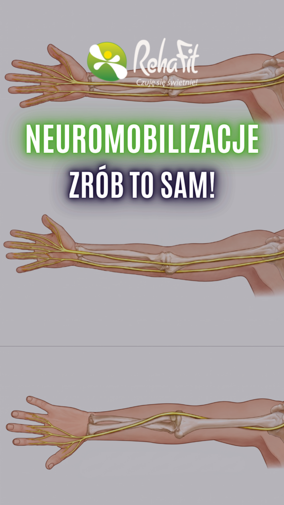 neuromobilizacje kończyny górnej